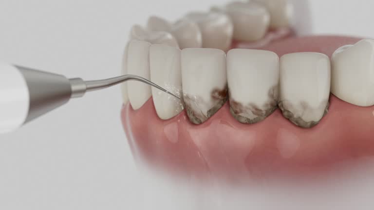 Reliable Dental Implants contractor in Ringgold, LA by Smile Center Dentistry